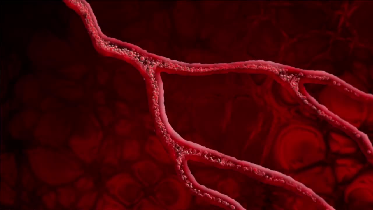 Cardiologist shares ways to keep blood pressure down during winter - Vimarsana News