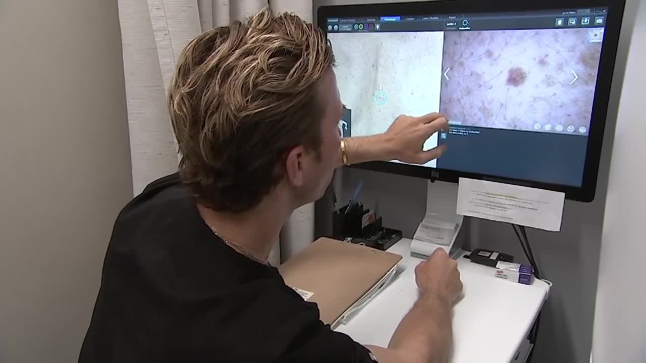 Your Healthy Family: 3-D Skin cancer scanner - Vimarsana News