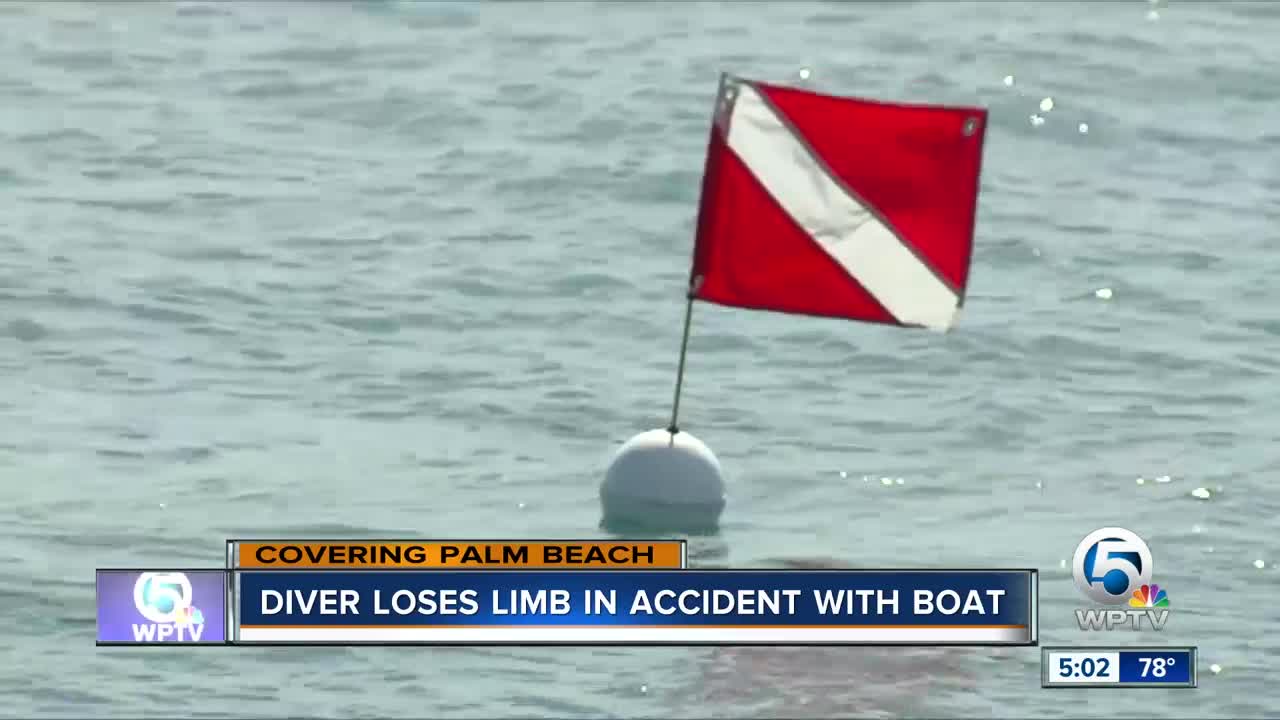 Diver who lost arm in boat accident ID'd