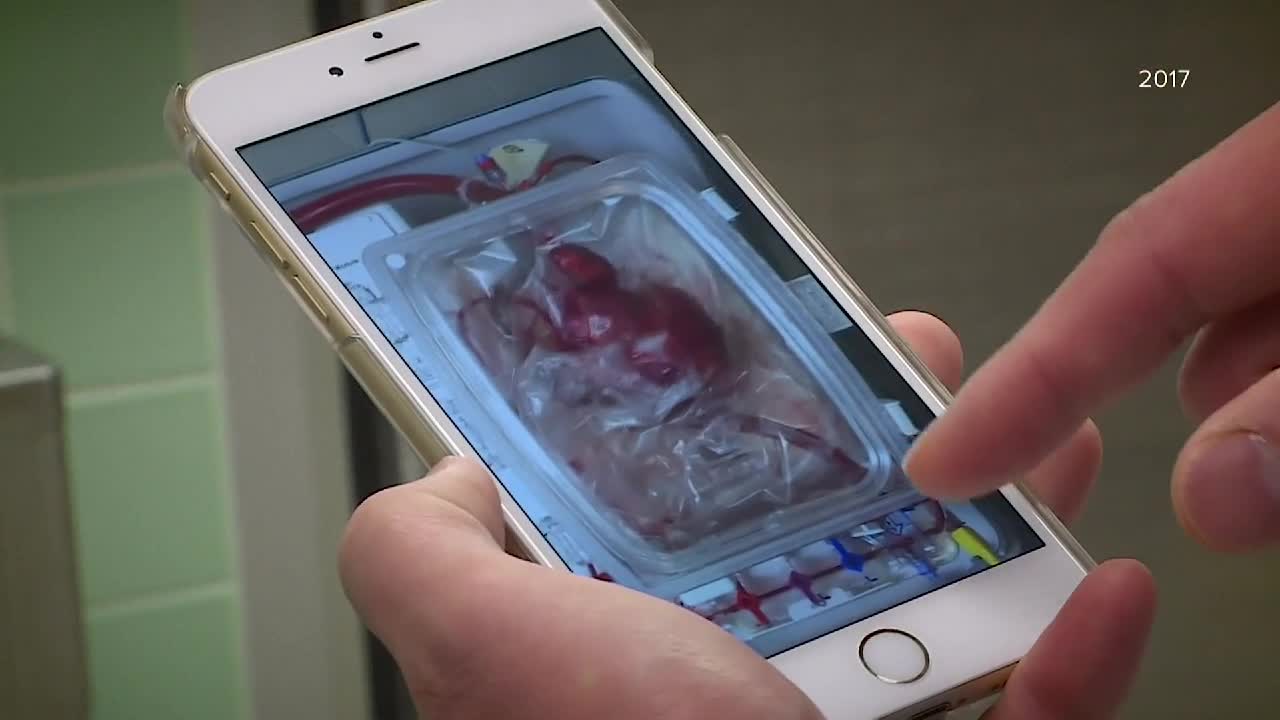 Your Healthy Family: FDA approves game changing heart transplant device - Vimarsana News